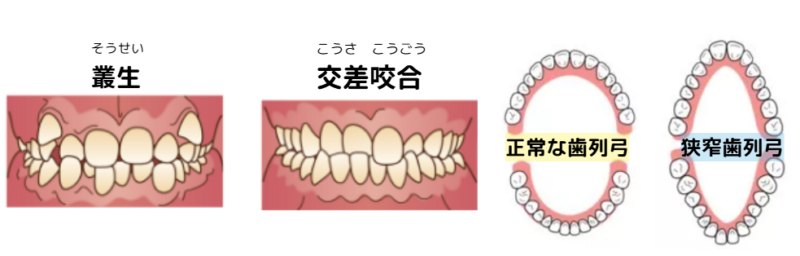 画像に alt 属性が指定されていません。ファイル名: image-6-800x256.png