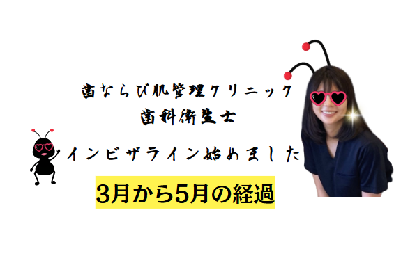 歯科衛生士インビザライン始めました3月~5月の経過の記録のアイキャッチ画像